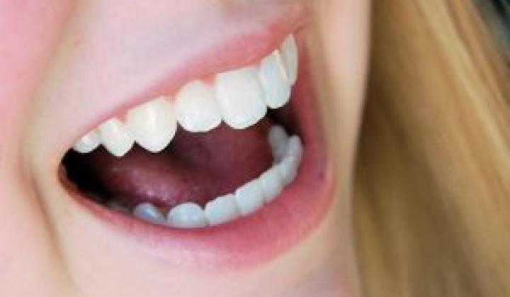 Jak odstranit zubní kámen