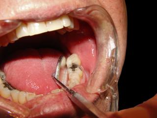 Jak poznat dobrého zubaře